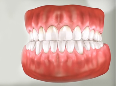 STRUCTURE OF A TOOTH
