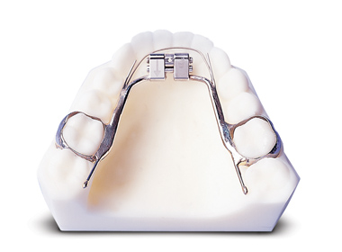 PALATAL EXPANDER