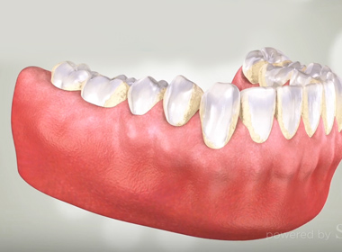 HEALTHY GUM